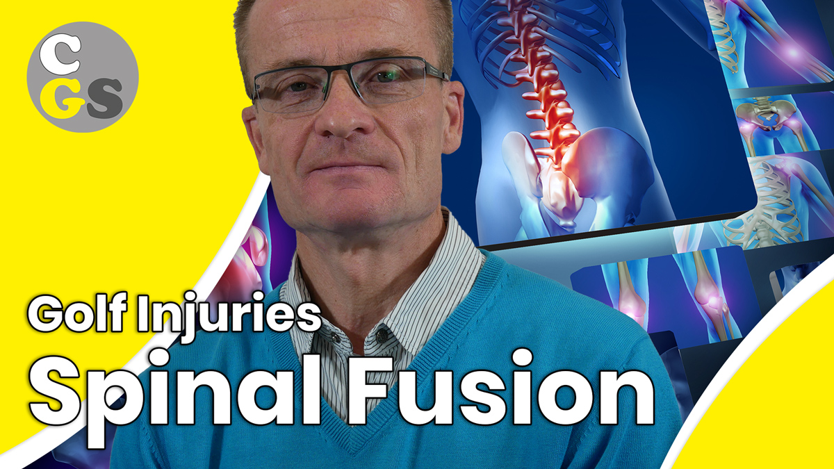 Golf Injuries - Spinal Fusion