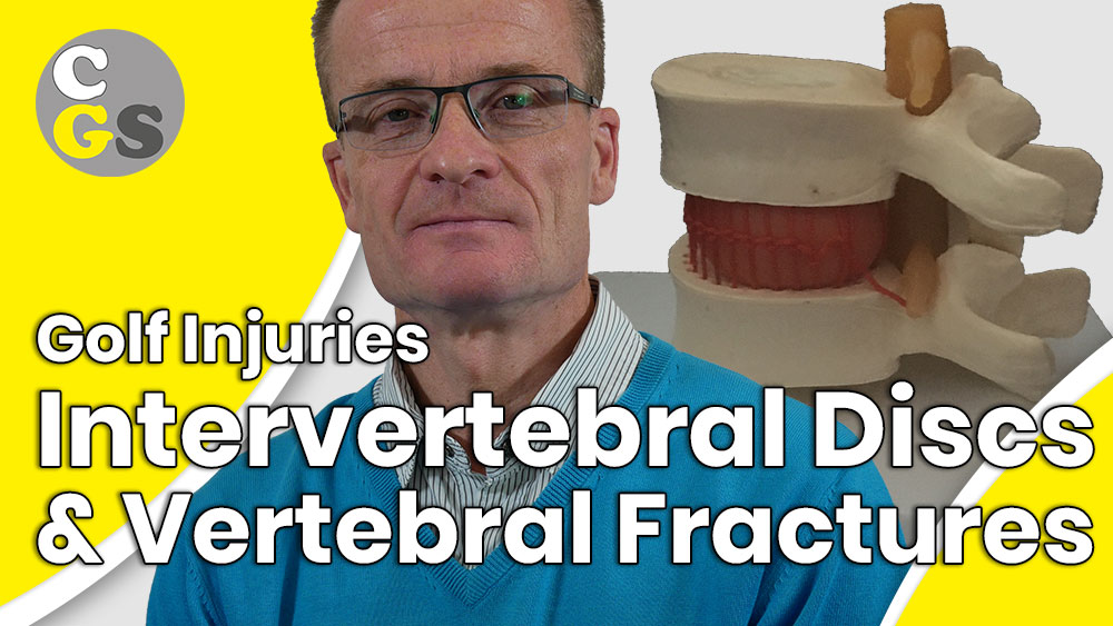 Golf Injuries: Vertebral Fractures